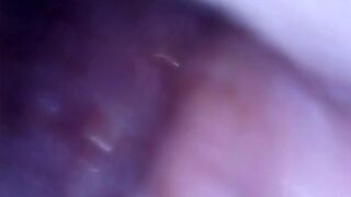 Mouth Endoscope