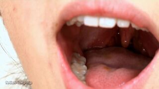 Thai Whore Uvula (rare Original Footage)
