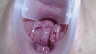 Teen Exploring Cervix & Deep Vagina with Speculum