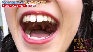 Uvula Examination on Japanese Street Girls