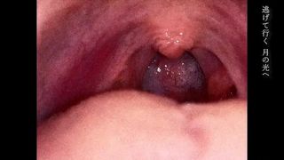 Inspecting the Uvula of a Japanese Idol